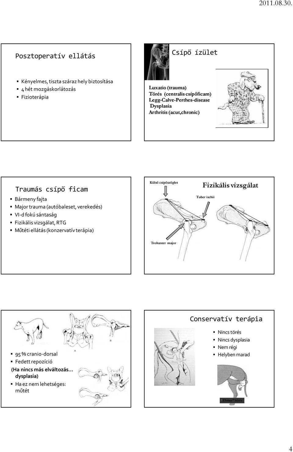 sántaság Fizikális vizsgálat, RTG Műtéti ellátás (konzervatív terápia) Külsı csípıszöglet Fizikális vizsgálat Tuber ischii Trohanter major 95 % cranio-dorsal