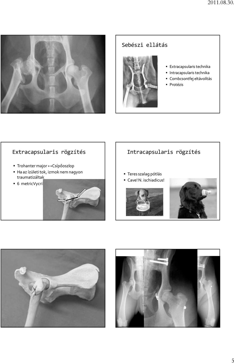 Intracapsularis rögzítés Trohanter major Csípőoszlop Ha az ízületi tok,