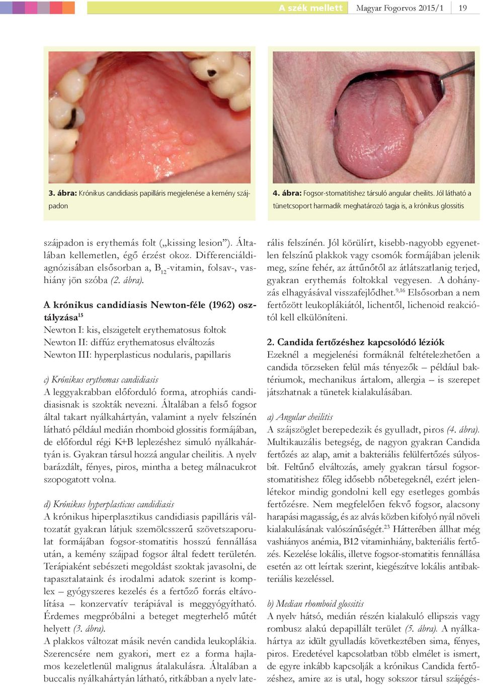 Differenciáldiagnózisában elsősorban a, B 12 -vitamin, folsav-, vashiány jön szóba (2. ábra).