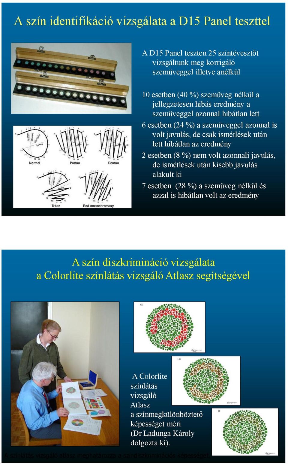 javulás, de ismétlések után kisebb javulás alakult ki 7 esetben (28 %) a szemüveg nélkül és azzal is hibátlan volt az eredmény A szín diszkrimináció vizsgálata a Colorlite színlátás vizsgáló