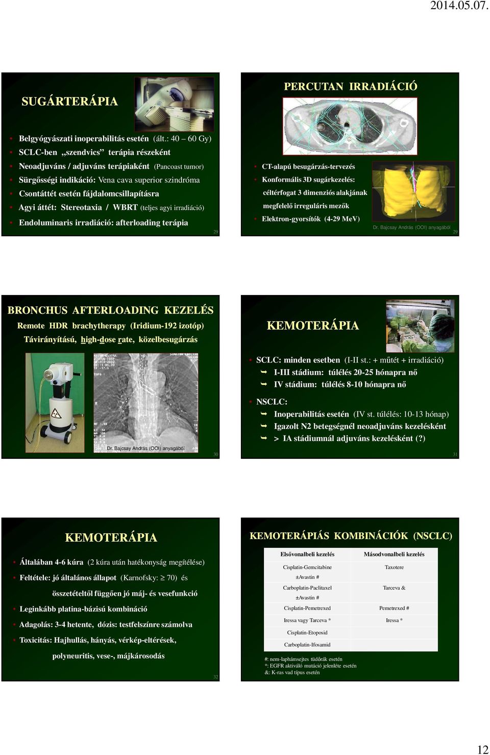 áttét: Stereotaxia / WBRT (teljes agyi irradiáció) Endoluminaris irradiáció: afterloading terápia 29 CT-alapú besugárzás-tervezés Konformális 3D sugárkezelés: céltérfogat 3 dimenziós alakjának