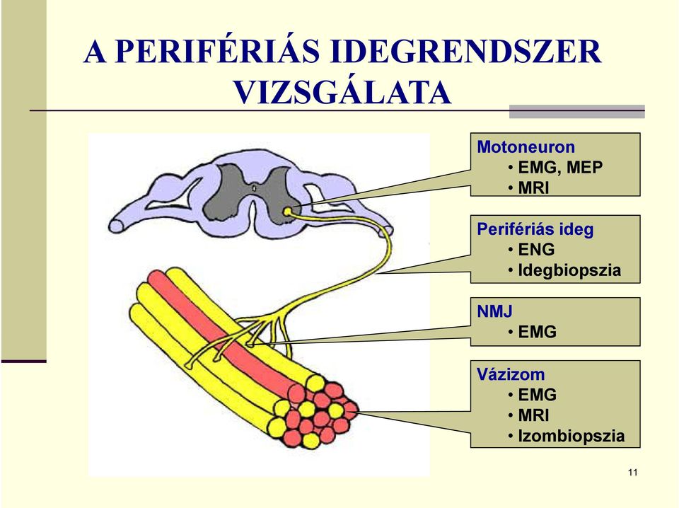 MRI Perifériás ideg ENG