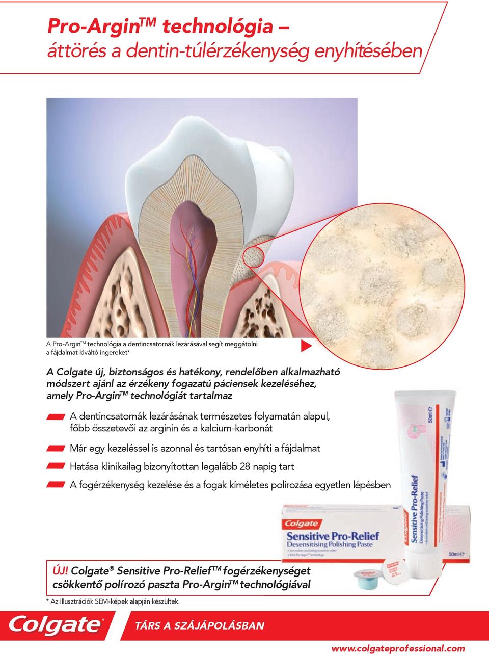 lezárásával segít meggátolni a fájdalmat kiváltó ingereket* TM A dentincsatornák lezárásának természetes