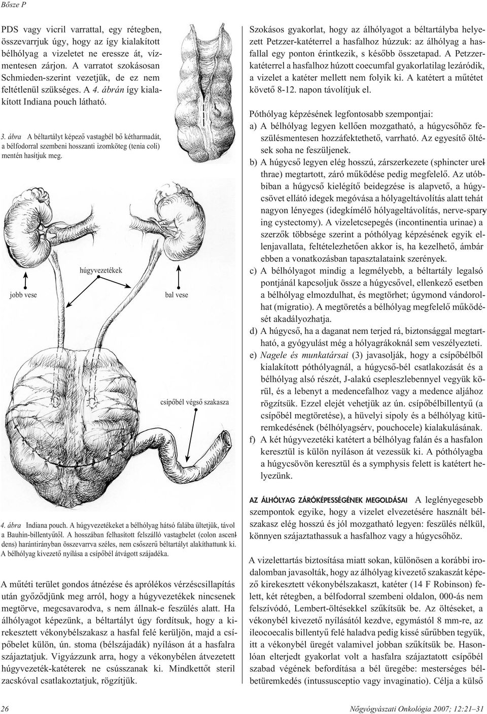 ábra A béltartályt képezô vastagbél bô kétharmadát, a bélfodorral szembeni hosszanti izomköteg (tenia coli) mentén hasítjuk meg. jobb vese húgyvezetékek bal vese csípôbél végsô szakasza 4.
