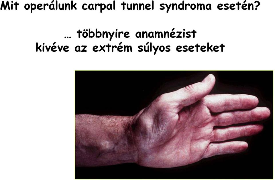 többnyire anamnézist