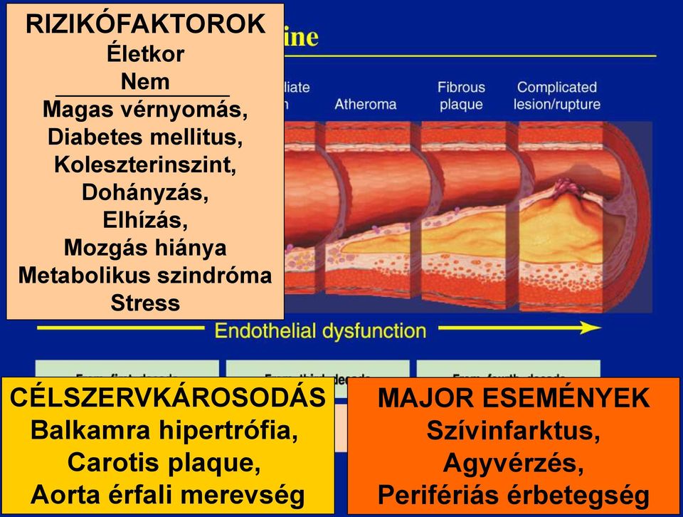 szindróma Stress CÉLSZERVKÁROSODÁS Balkamra hipertrófia, Carotis
