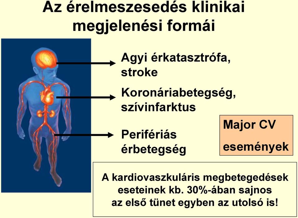 Perifériás érbetegség Major CV események A kardiovaszkuláris