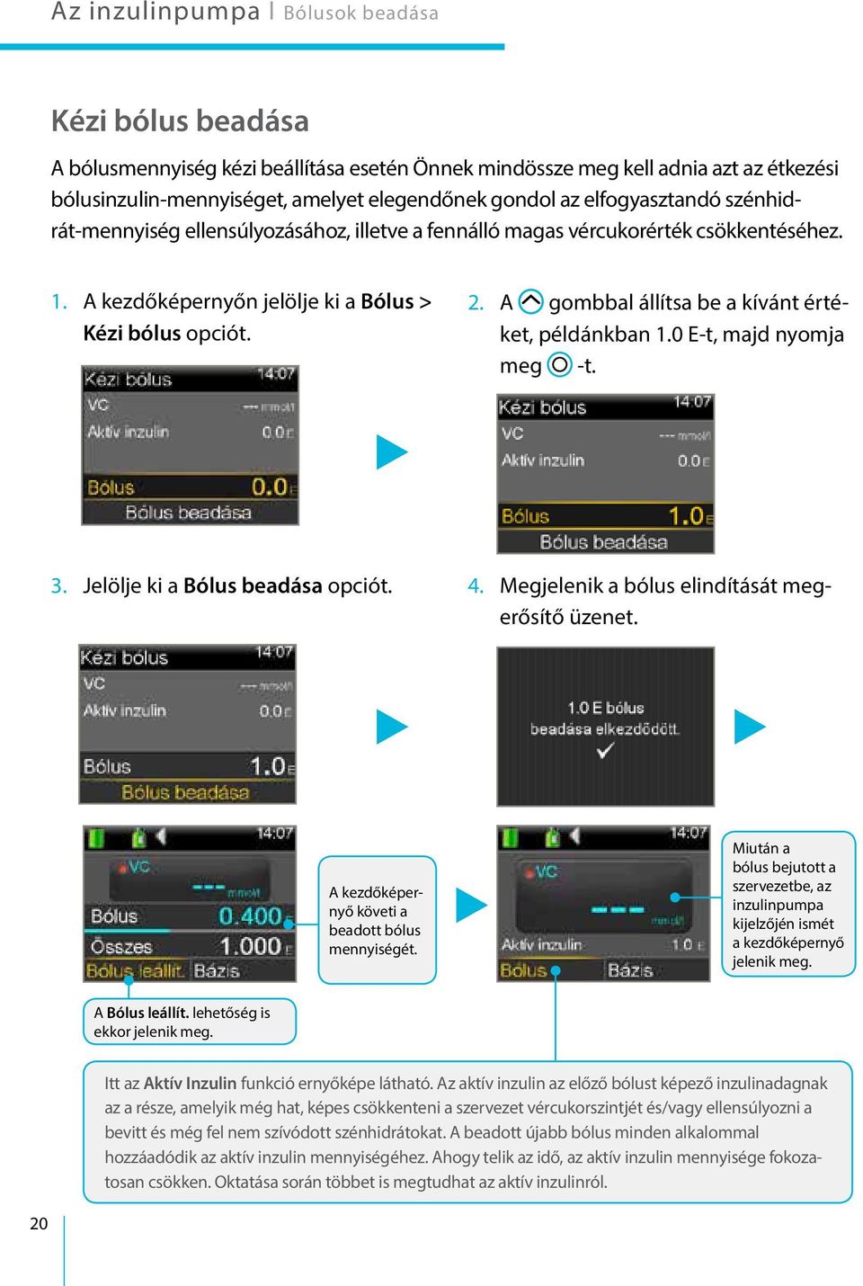 A gombbal állítsa be a kívánt értéket, példánkban 1.0 E-t, majd nyomja meg -t. 3. Jelölje ki a Bólus beadása opciót. 4. Megjelenik a bólus elindítását megerősítő üzenet.