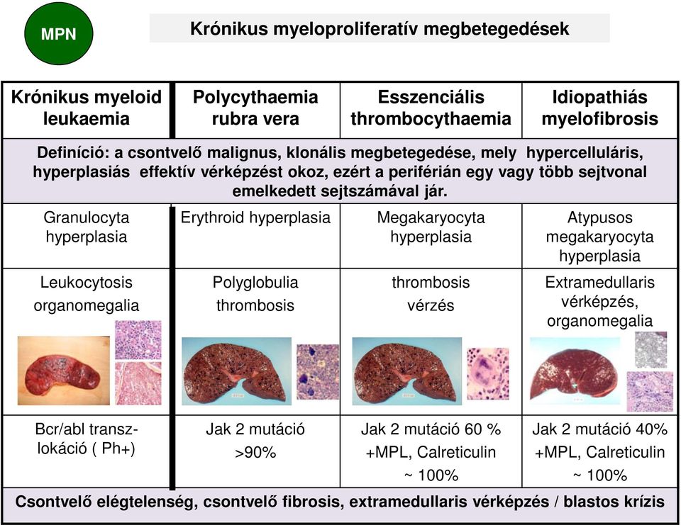 Granulocyta hyperplasia Erythroid hyperplasia Megakaryocyta hyperplasia Atypusos megakaryocyta hyperplasia Leukocytosis organomegalia Polyglobulia thrombosis thrombosis vérzés Extramedullaris