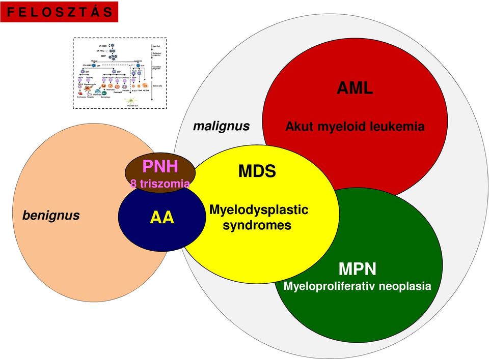 triszomia AA MDS Myelodysplastic