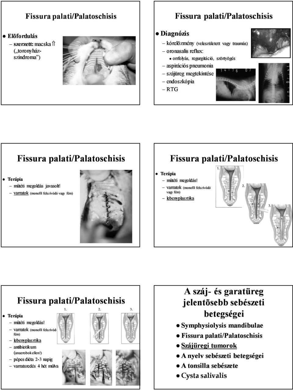 varratok (monofil felszívódó vagy fém) Fissura palati/palatoschisis Terápia mûtéti megoldás! varratok (monofil felszívódó vagy fém) lebenyplasztika 1. 2. 3.