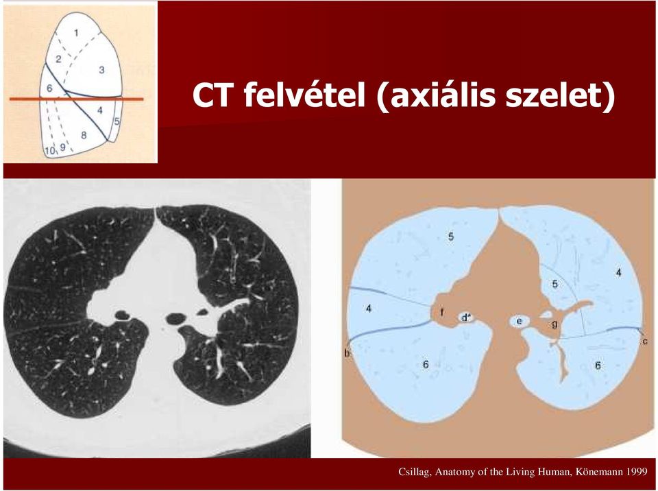 Csillag, Anatomy of