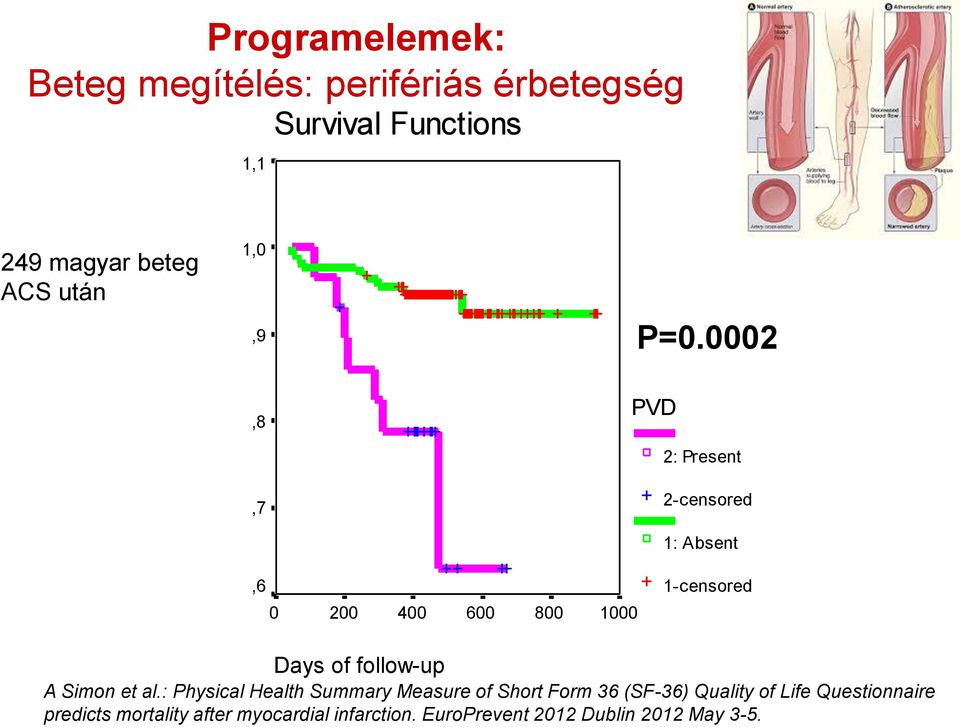 0002,8 PVD Cum Survival,7,6 0 200 400 600 800 1000 2: Present 2-censored 1: Absent 1-censored Days of