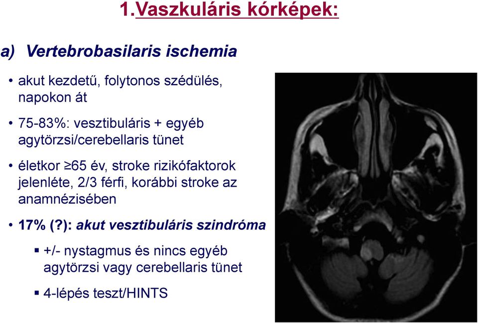 Vaszkuláris kórképek: életkor 65 év, stroke rizikófaktorok jelenléte, 2/3 férfi, korábbi