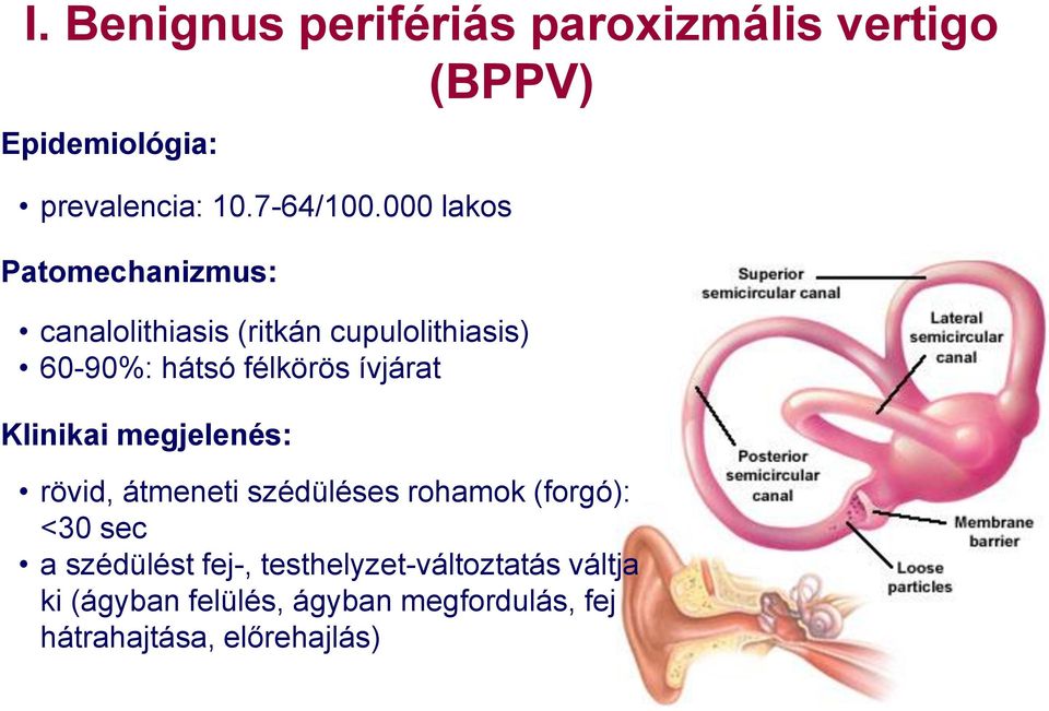 ívjárat Klinikai megjelenés: rövid, átmeneti szédüléses rohamok (forgó): <30 sec a szédülést