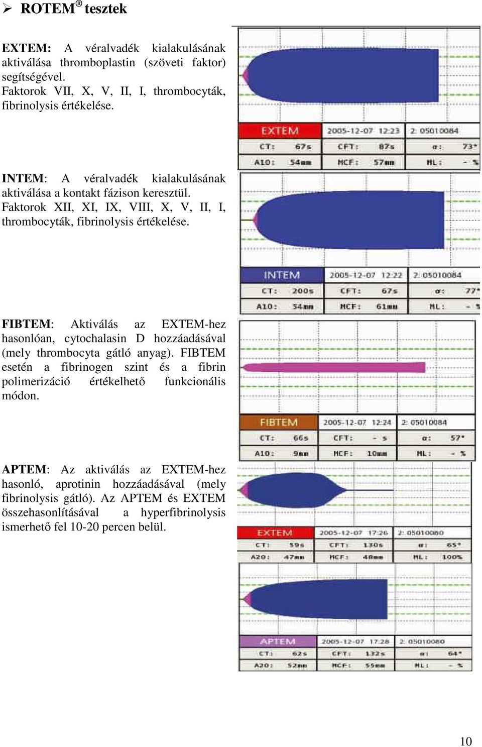 FIBTEM: Aktiválás az EXTEM-hez hasonlóan, cytochalasin D hozzáadásával (mely thrombocyta gátló anyag).