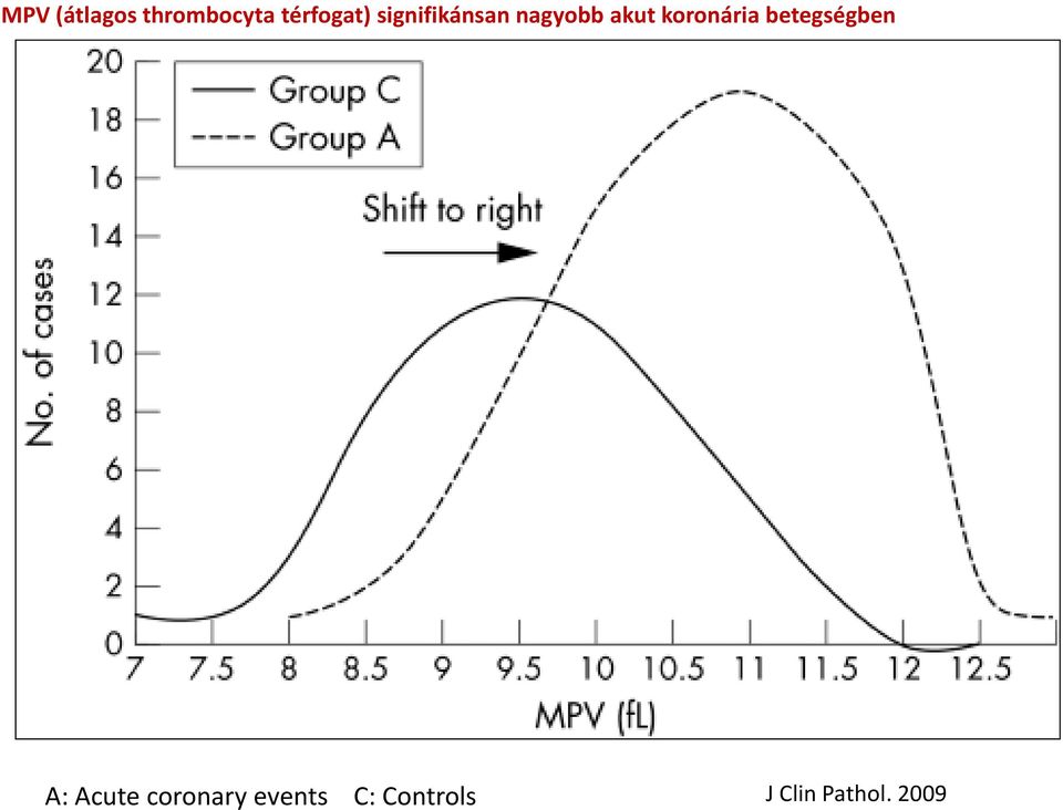 betegségben MPV M A: Acute coronary