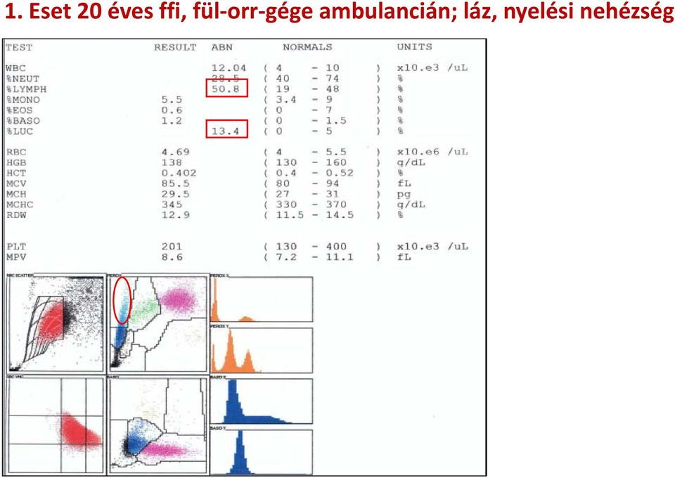 fül-orr-gége