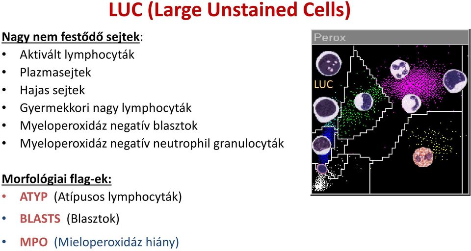 negatív blasztok Myeloperoxidáz negatív neutrophil granulocyták Morfológiai