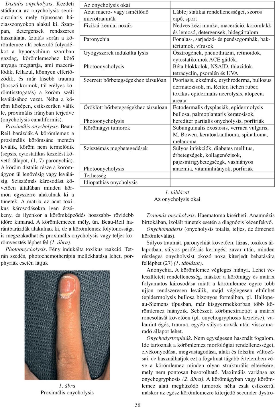 elfertôzôdik, és már kisebb trauma (hosszú körmök, túl erélyes körömtisztogatás) a köröm széli leválásához vezet.