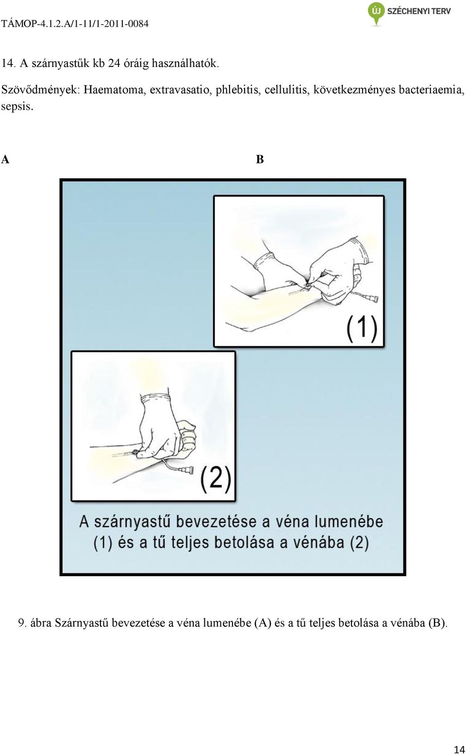 cellulitis, következményes bacteriaemia, sepsis. A B 9.