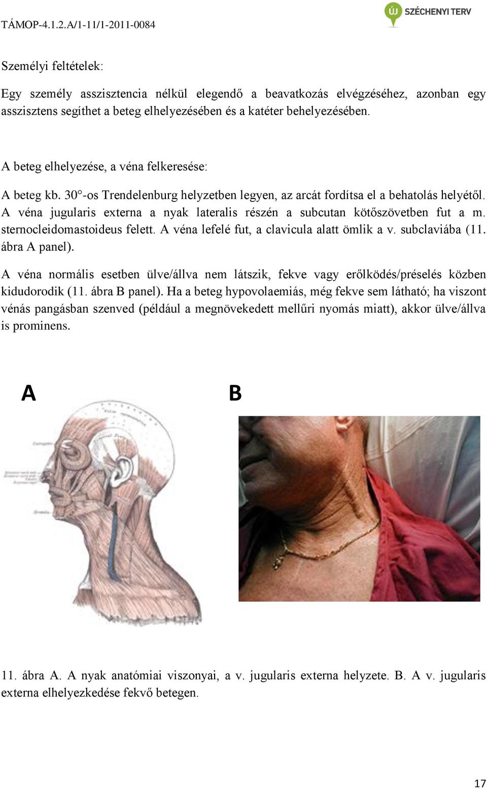 A véna jugularis externa a nyak lateralis részén a subcutan kötőszövetben fut a m. sternocleidomastoideus felett. A véna lefelé fut, a clavicula alatt ömlik a v. subclaviába (11. ábra A panel).