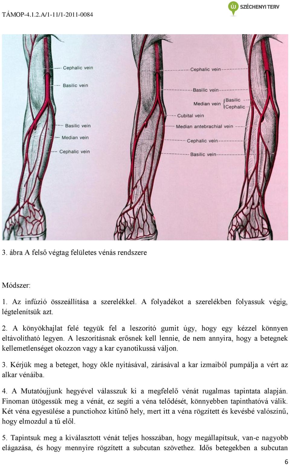 A fejezet célja Alapfogalmak Bevezetés I. Katéter a tűn technika II.  Szárnyastű behelyezése PDF Free Download