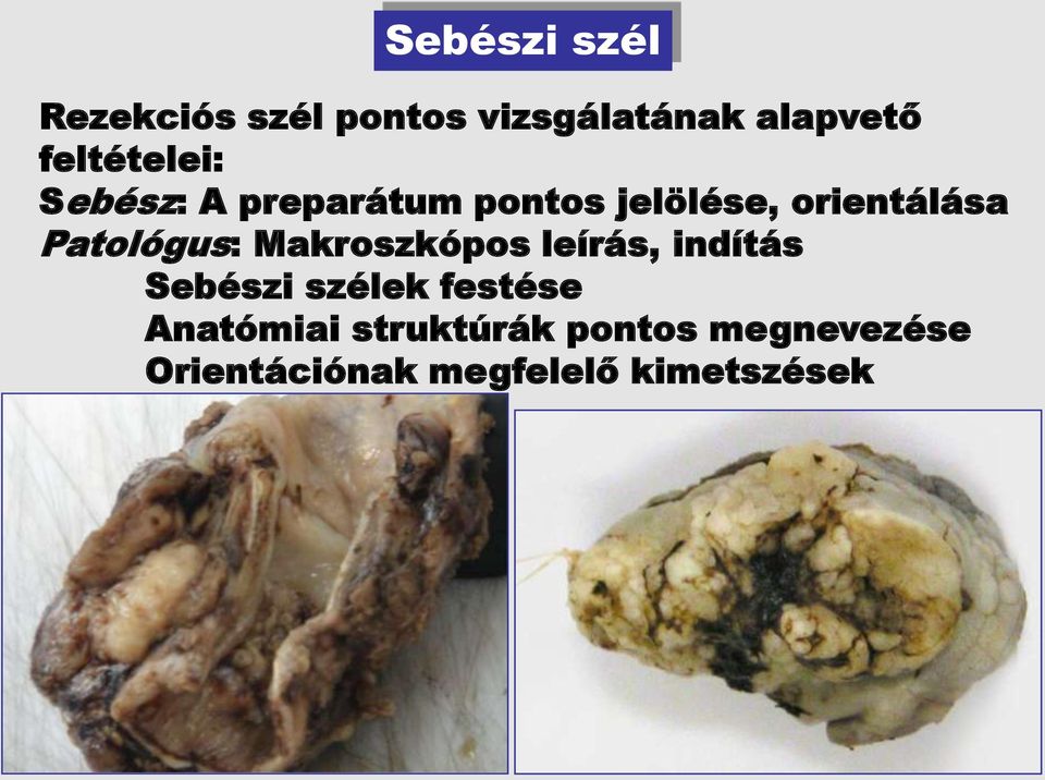 Patológus: Makroszkópos leírás, indítás Sebészi szélek festése