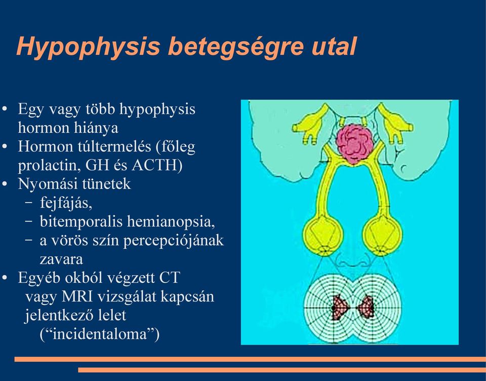 fejfájás, bitemporalis hemianopsia, a vörös szín percepciójának zavara