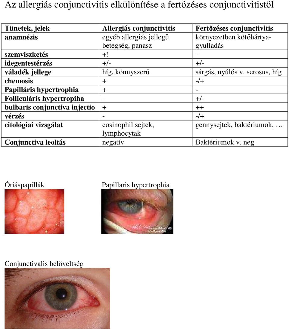 serosus, híg chemosis + -/+ Papilláris hypertrophia + - Folliculáris hypertropiha - +/- bulbaris conjunctiva injectio + ++ vérzés - -/+ citológiai vizsgálat