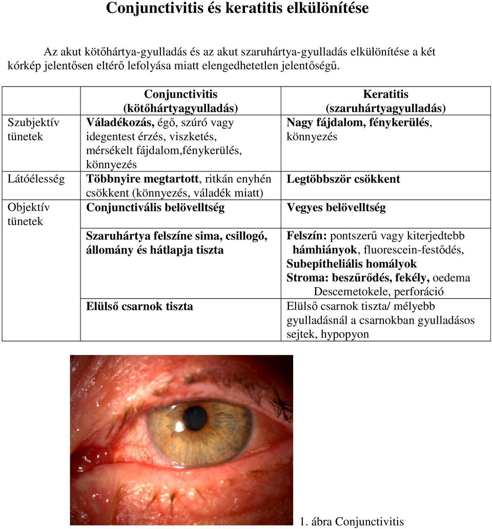 megtartott, ritkán enyhén csökkent (könnyezés, váladék miatt) Conjunctivális belövelltség Szaruhártya felszíne sima, csillogó, állomány és hátlapja tiszta Elülső csarnok tiszta Keratitis