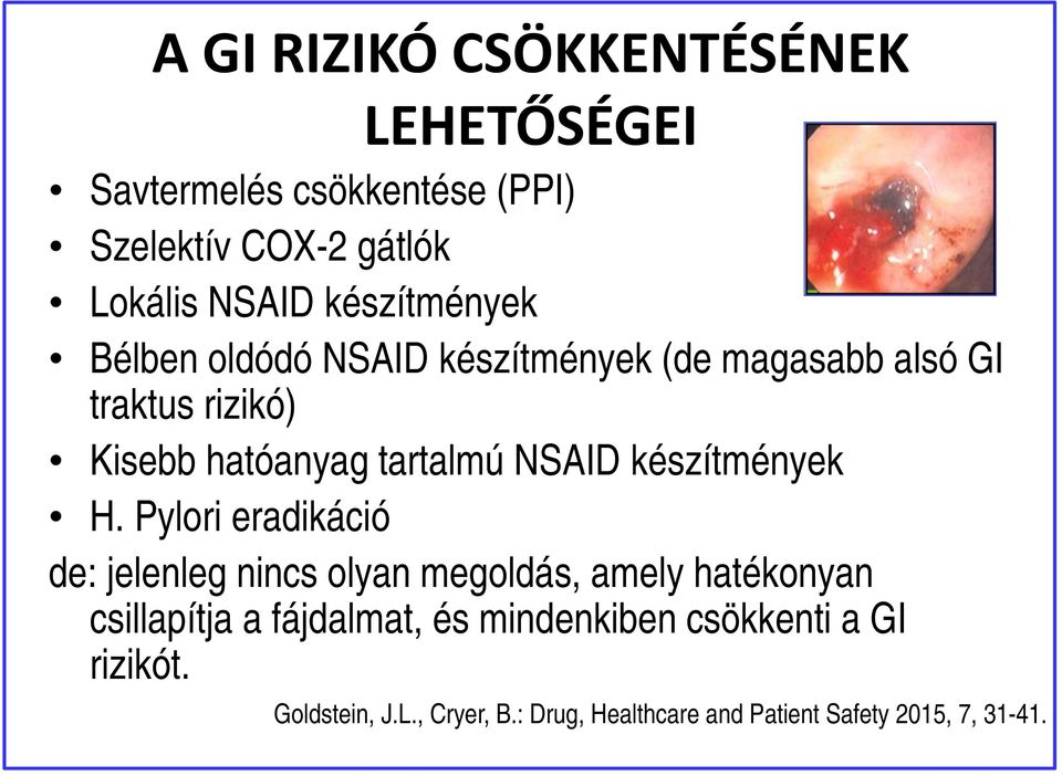 NSAID készítmények H.