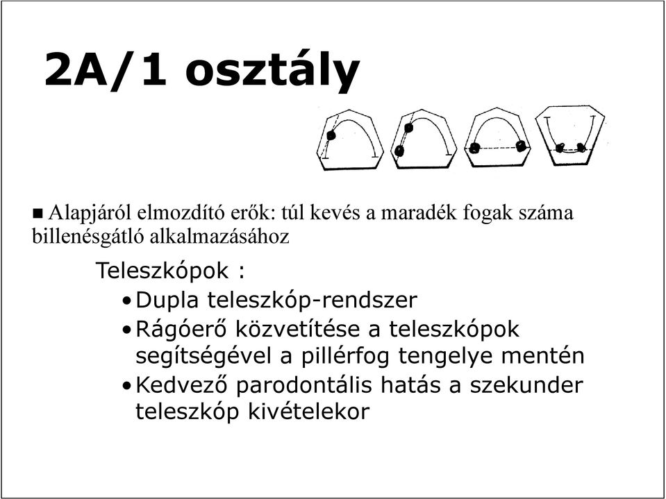 teleszkóp-rendszer Rágóerő közvetítése a teleszkópok segítségével