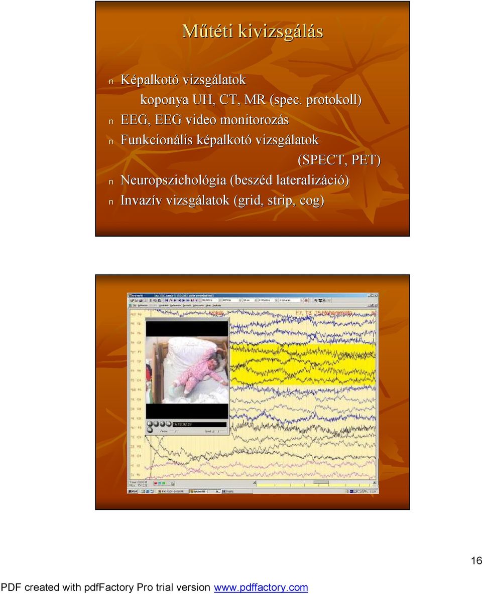 . protokoll) EEG, EEG video monitorozás Funkcionális képalkotk