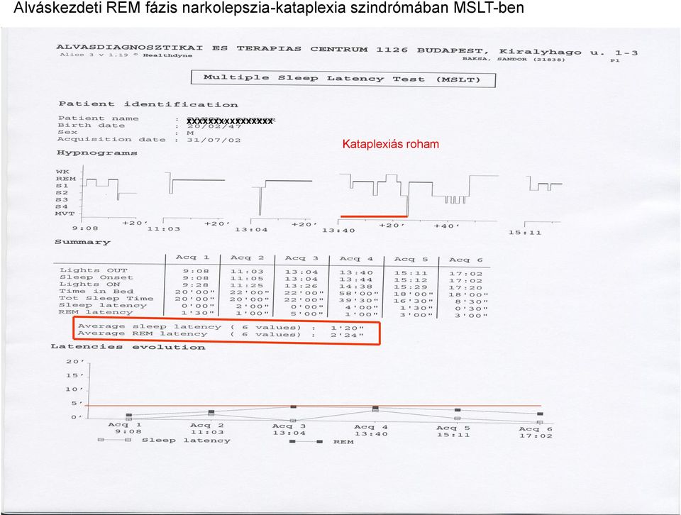 szindrómában MSLT-ben