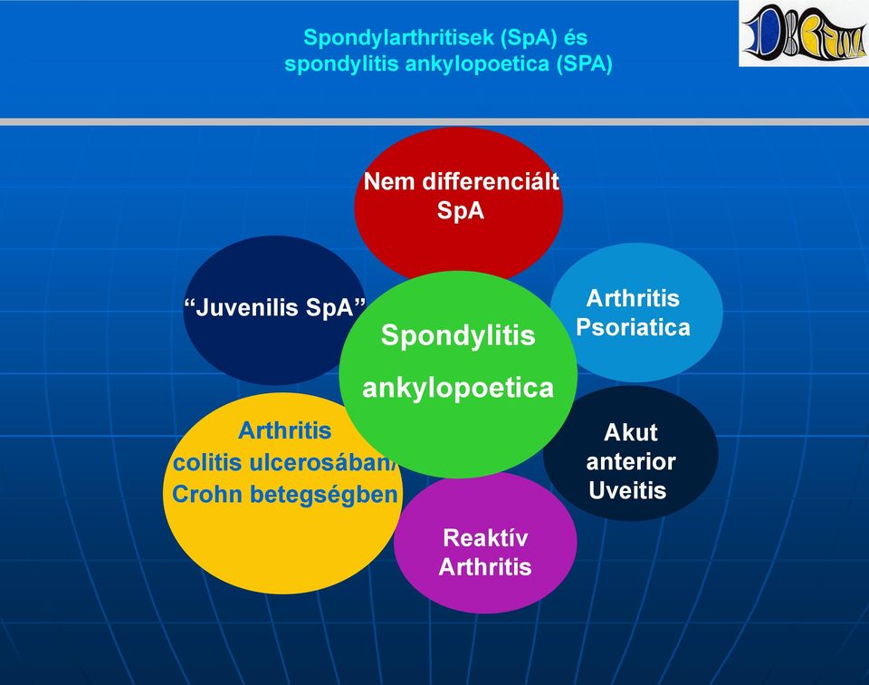 colitis ulcerosában/ Crohn betegségben Spondylitis