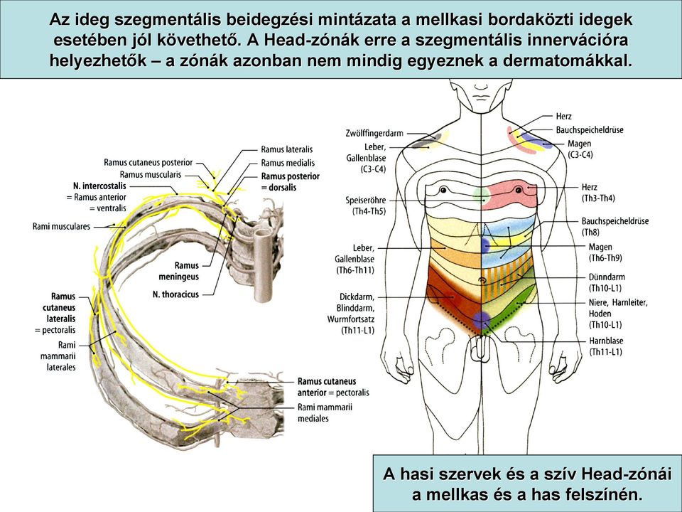 . A Head-zónák k erre a szegmentális innerváci cióra helyezhetők a zónák z