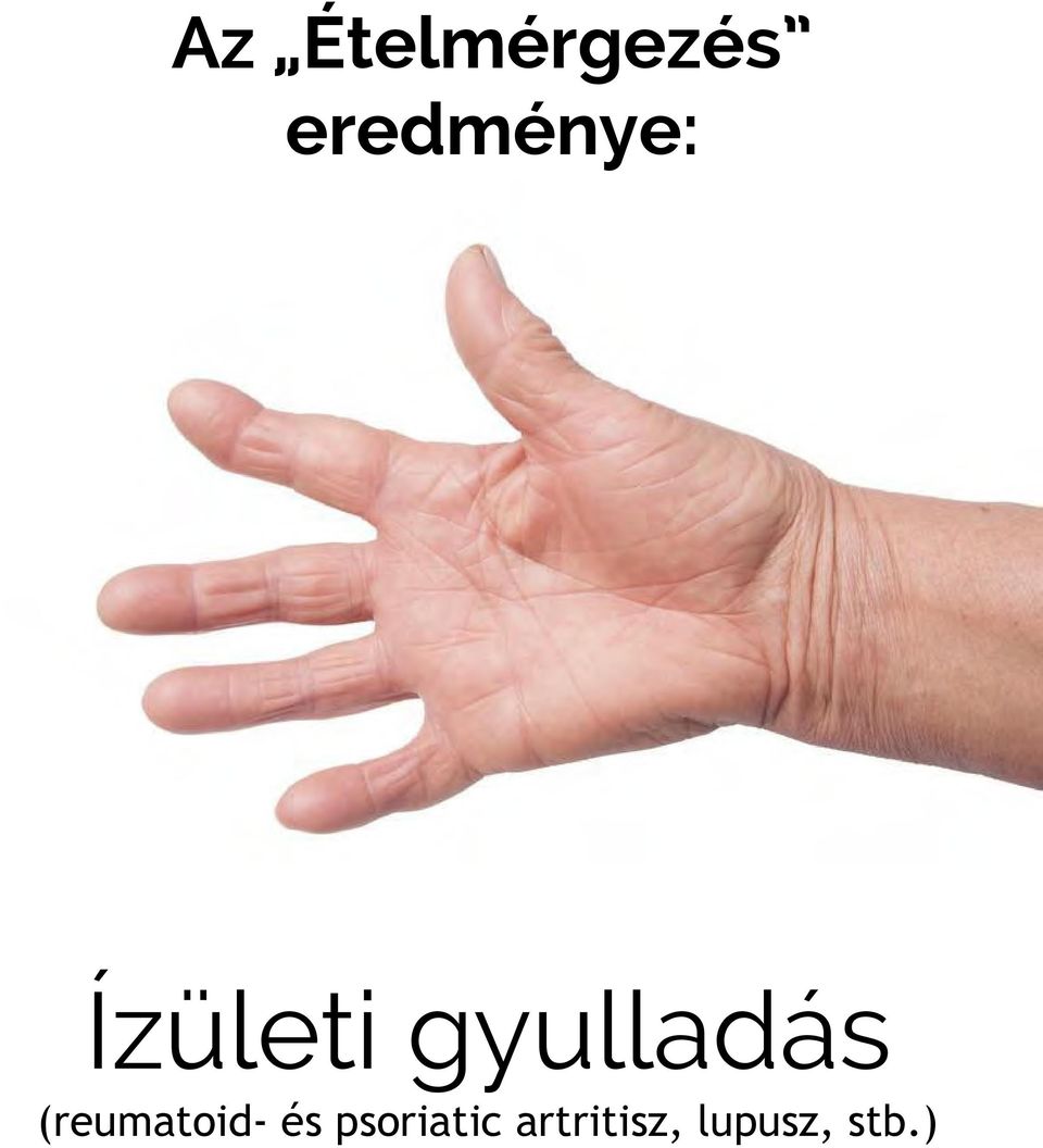 gyulladás (reumatoid-