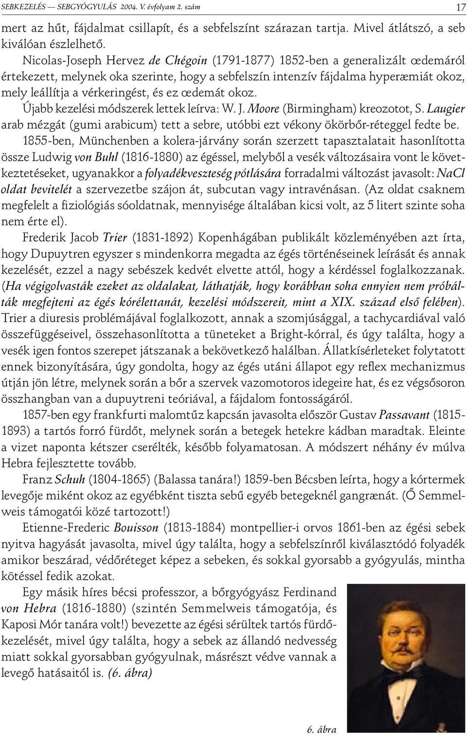 ez œdemát okoz. Újabb kezelési módszerek lettek leírva: W. J. Moore (Birmingham) kreozotot, S. Laugier arab mézgát (gumi arabicum) tett a sebre, utóbbi ezt vékony ökörbőr-réteggel fedte be.