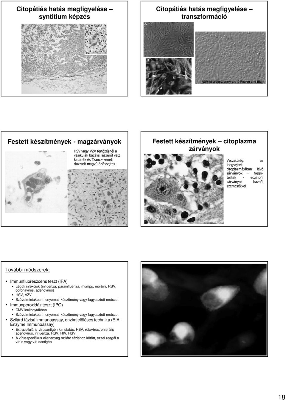 További módszerek: Immunfluoreszcens teszt (IFA) Légúti infekciók (influenza, parainfluenza, mumps, morbilli, RSV, coronavirus, adenovirus) HSV, VZV Szövetmintákban: lenyomati készítmény vagy