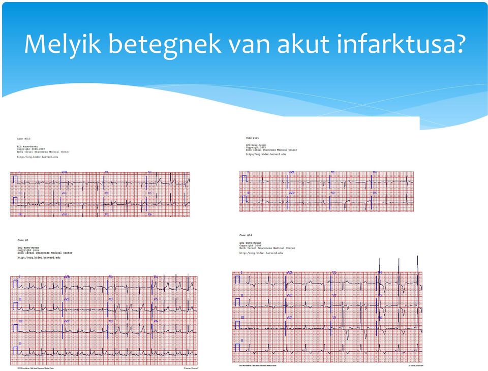 van akut