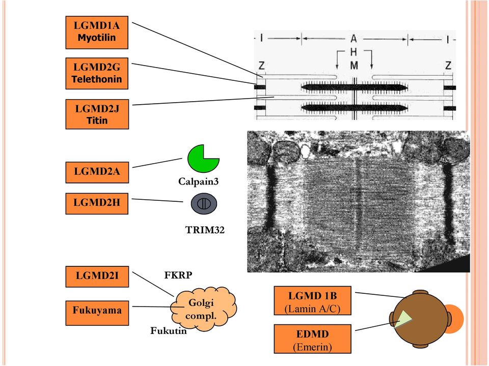 TRIM32 LGMD2I Fukuyama FKRP Golgi