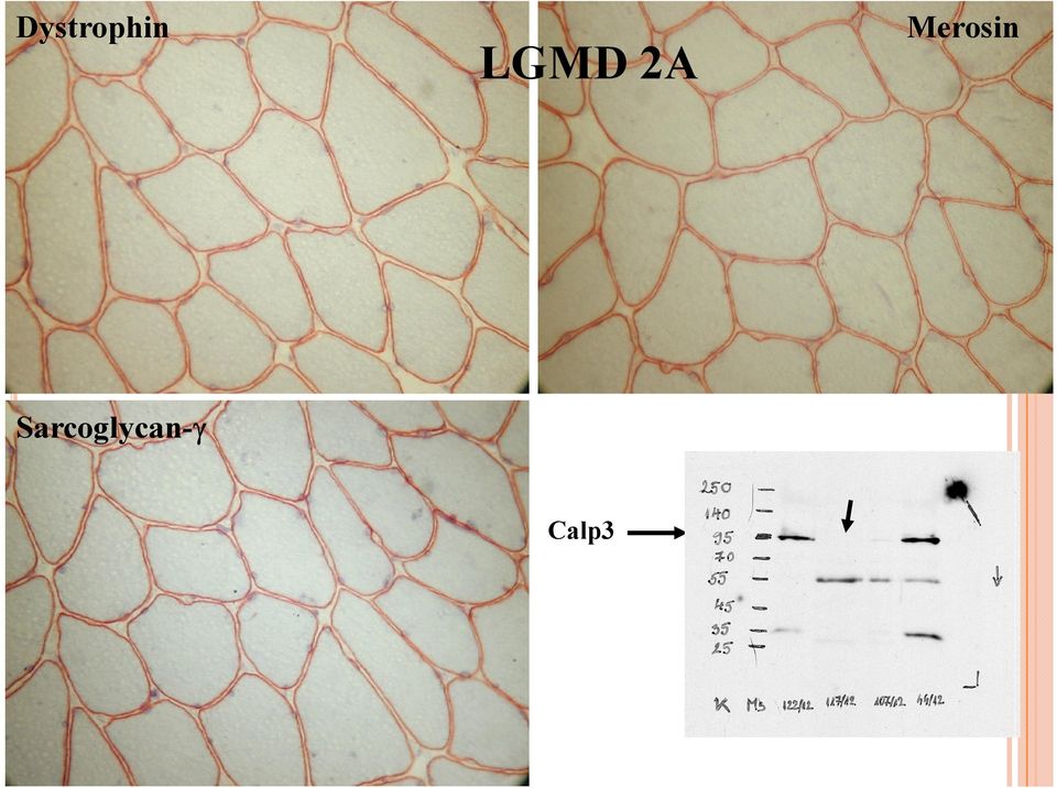 Merosin