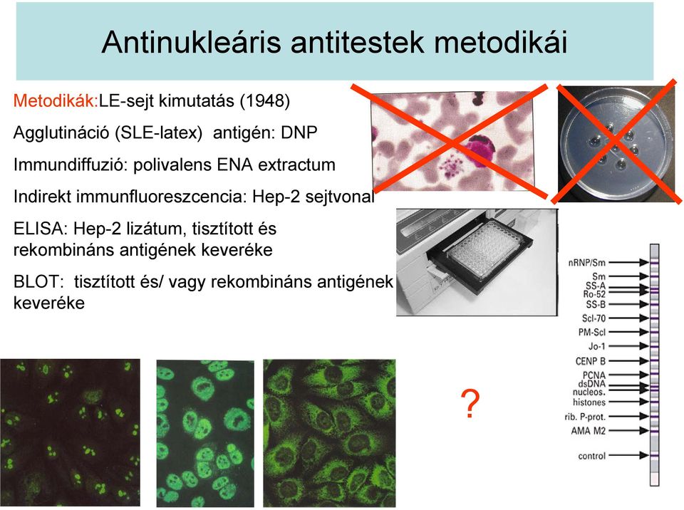 Indirekt immunfluoreszcencia: Hep-2 sejtvonal ELISA: Hep-2 lizátum, tisztított