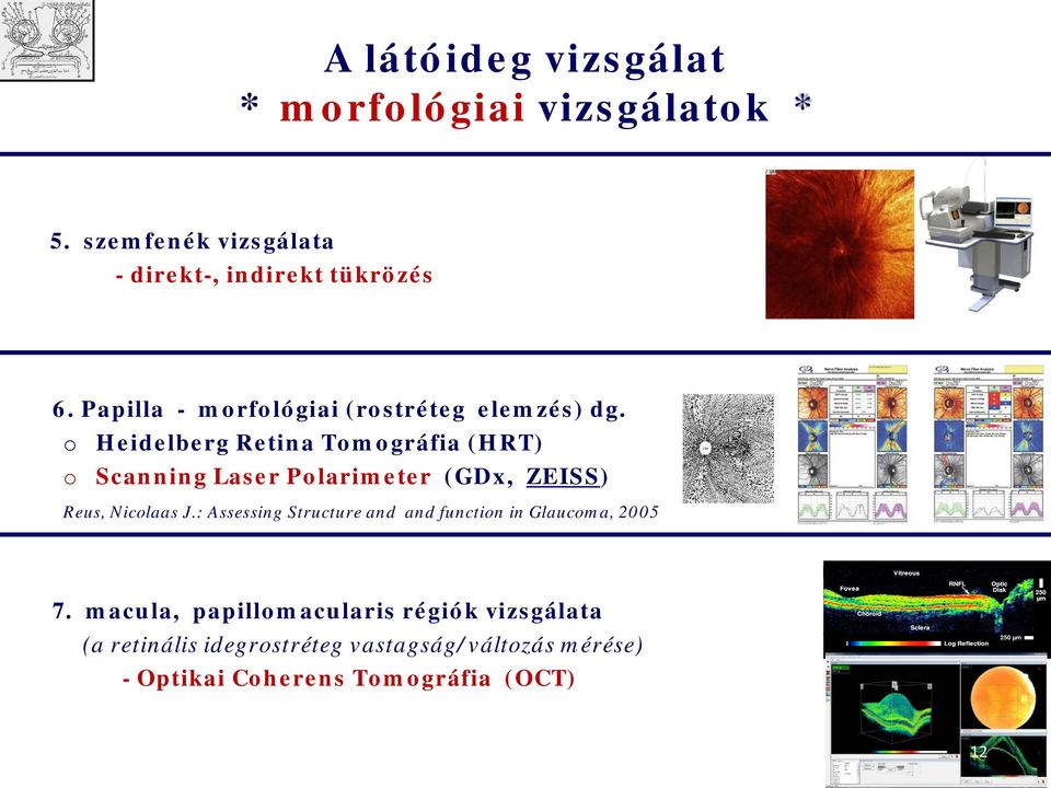 Heidelberg Retina Tmgráfia (HRT) Scanning Laser Plarimeter (GDx, ZEISS) Reus, Niclaas J.