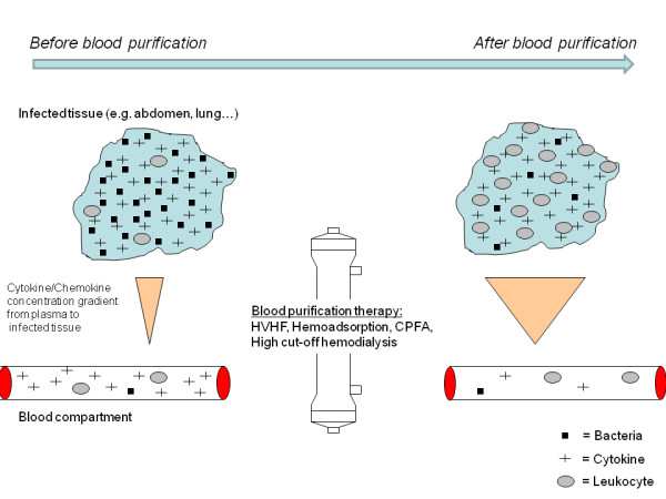 VESEPÓTL TLÓ KEZELÉSEK INDIKÁCI CIÓJA SZEPSZISBEN RRT SZEPTIKUS VESEKÁROSOD ROSODÁSBANSBAN RRT IMMUNOMODULÁTOR TERÁPIA kiesett vesefunkció