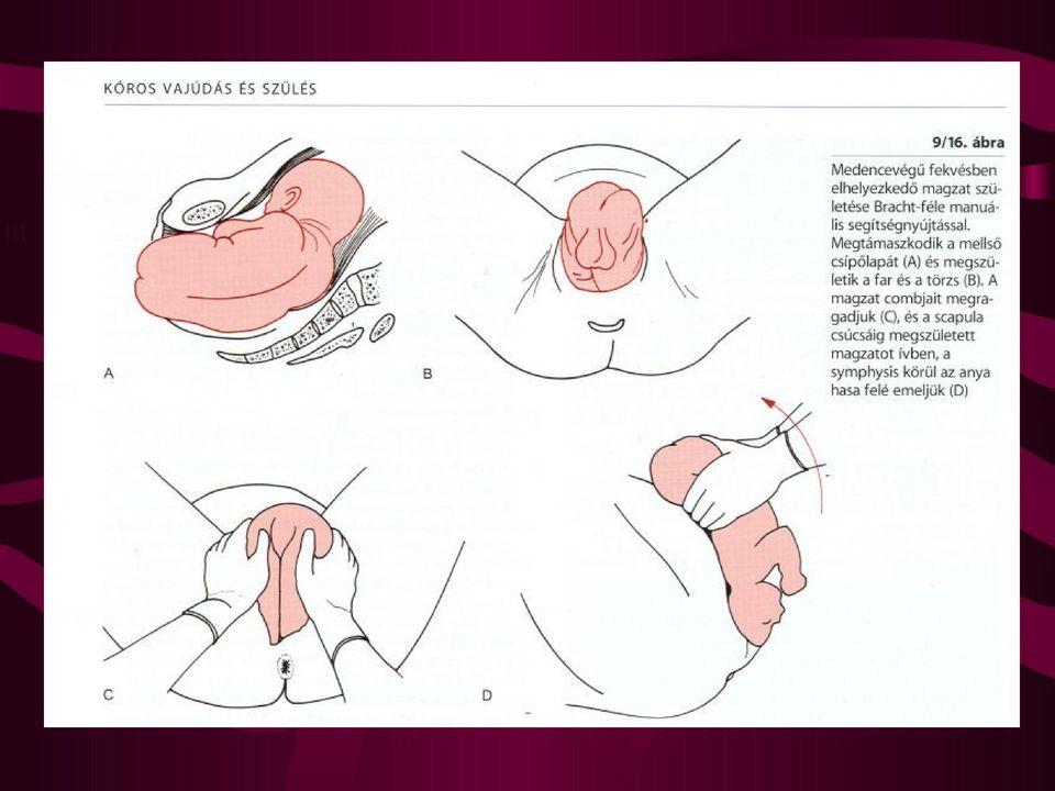 A szülészeti nőgyógyászati oxiológia aktualitásai - PDF Ingyenes letöltés