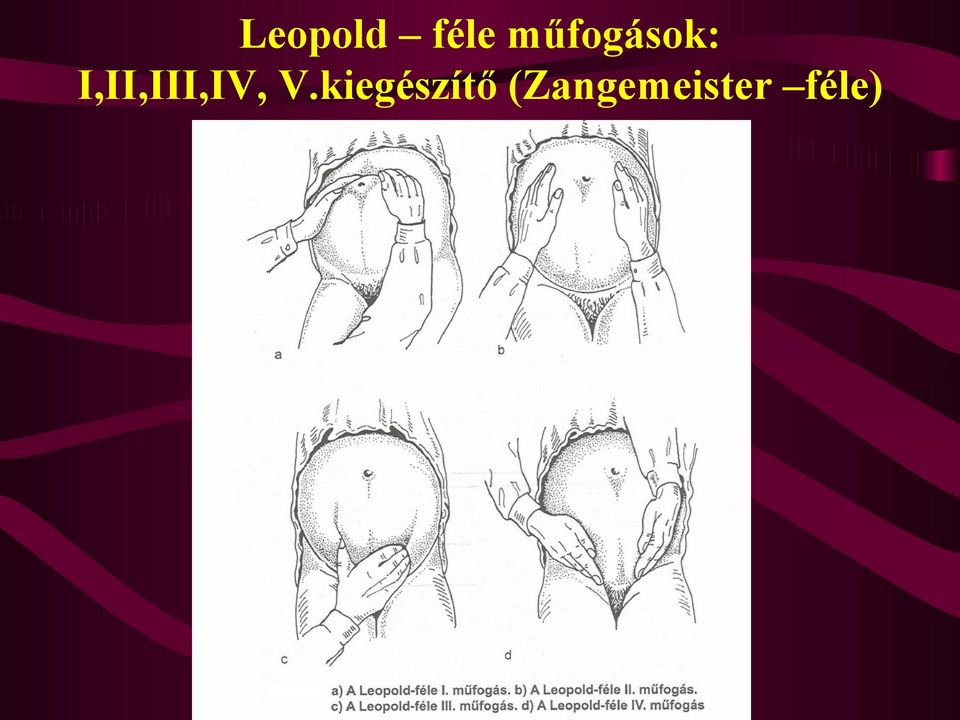 A szülészeti nőgyógyászati oxiológia aktualitásai - PDF Ingyenes letöltés