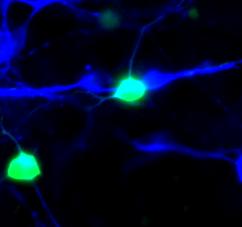 A1 A2 A3 GFP MAP2 GFP/MAP2 * * * B1 GFP B2 GFAP B3 GFP/GFAP 39. Ábra: Az érett idegsejtek közelsége nem indukált idő előtti asztroglia képződést. A differenciáció 4.
