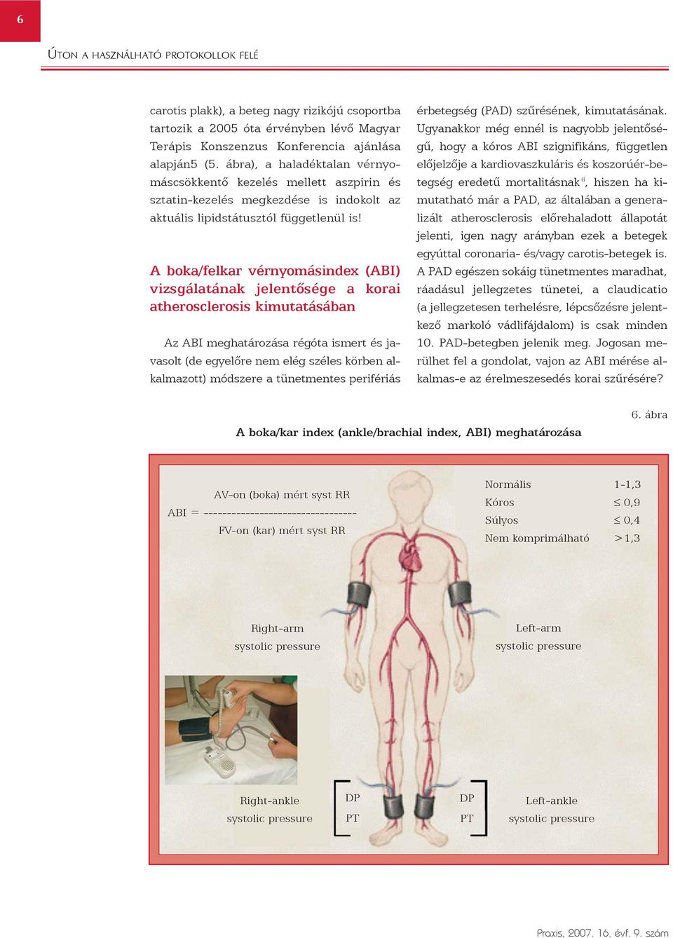 A boka/felkar vérnyomásindex (ABI) vizsgálatának jelentõsége a korai atherosclerosis kimutatásában Az ABI meghatározása régóta ismert és javasolt (de egyelõre nem elég széles körben alkalmazott)